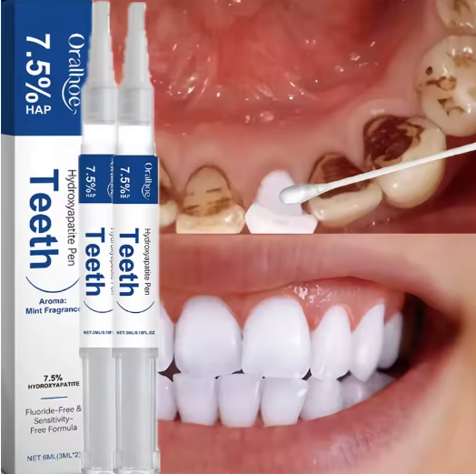 עט הסרת כתמי שיניים סרום להלבנת שיניים מפחית כתמים מפחית שיניים צהובות מרענן סרום להלבנת שיניים דינטה